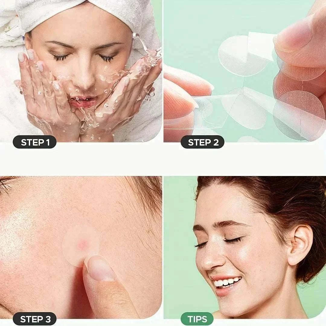 Hydrocolloid Acne Patches